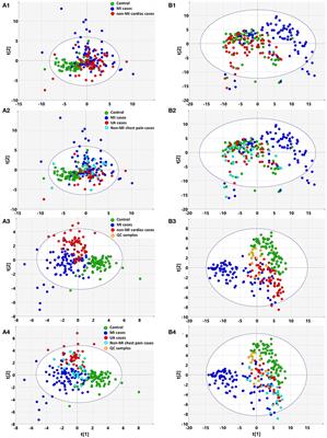 Plasma Metabolites Alert Patients With Chest Pain to Occurrence of Myocardial Infarction